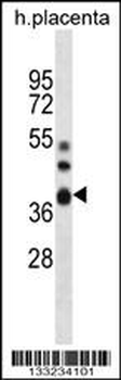NT5C3L Antibody (N-term)