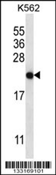 CHAC2 Antibody (Center)