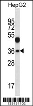 WDR45L Antibody (N-term)