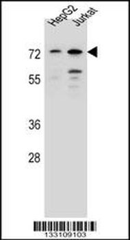 DACH2 Antibody (N-term)
