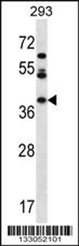 MIOX Antibody (N-term)