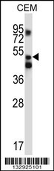 XPNPEP3 Antibody (C-term)