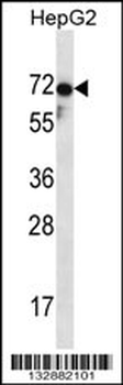 ZP1 Antibody (C-term)