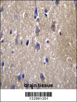 CPN2 Antibody (N-term)