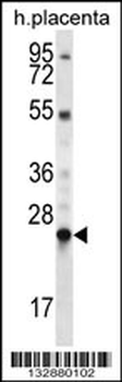 LHFPL1 Antibody (N-term)
