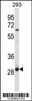 MRAP2 Antibody (Center)