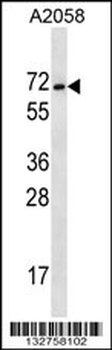 MAGEE2 Antibody (C-term)