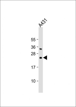 Bad Antibody (Center)