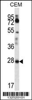 RARRES1 Antibody (C-term)