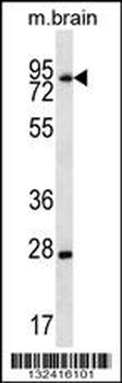 LIMD1 Antibody (C-term)