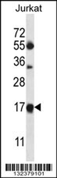 MRPL41 Antibody (N-term)