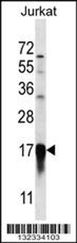 PFDN5 Antibody (Center)