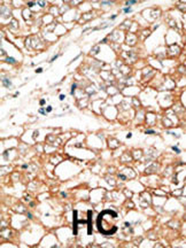 Bok BH3 Domain Antibody