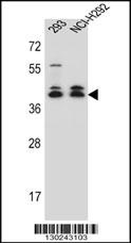 DMRTC2 Antibody (Center)
