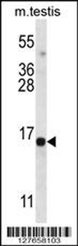 SPT19 Antibody (C-term)