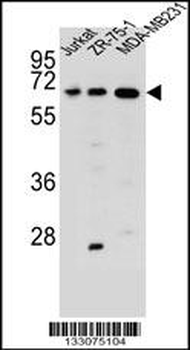 ZSCAN2 Antibody (N-term)