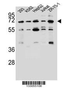 KCNV2 Antibody (C-term)