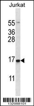 DDIT3 Antibody (Center)