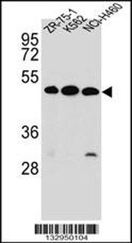 KREMEN2 Antibody (Center)