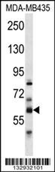 PTDSS2 Antibody (N-term)
