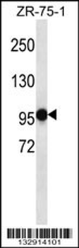 PHF14 Antibody (N-term)