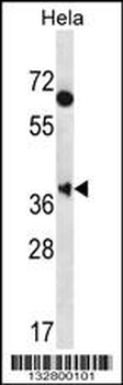 MBNL2 Antibody (C-term)