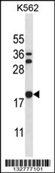 STMN3 Antibody (C-term)