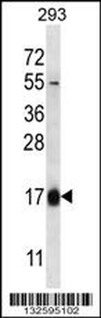 HBQ1 Antibody (N-term)