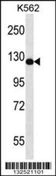 RASAL2 Antibody (Center)