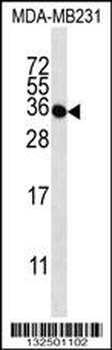 TAS2R1 Antibody (C-term)