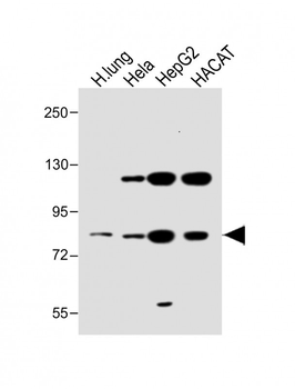 SLC6A14 Antibody (C-term)