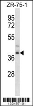 FPR3 Antibody (C-term)