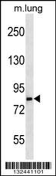 LRSAM1 Antibody (N-term)