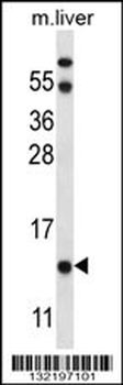 UQCRB Antibody (Center)
