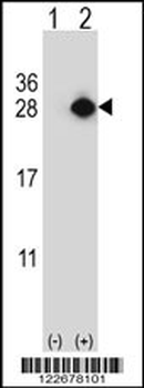 YEATS4 Antibody