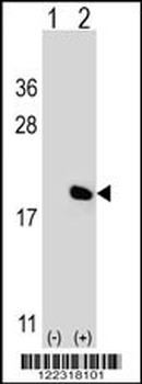IL17A Antibody (Center)
