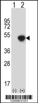 GCAT Antibody (N-term)