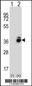 CRHBP Antibody (N-term)