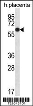 GLCCI1 Antibody (Center)
