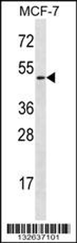 LAD1 Antibody (N-term)
