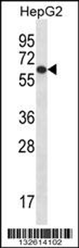 TBC1D22A Antibody (C-term)