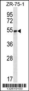 SEC62 Antibody (N-term)