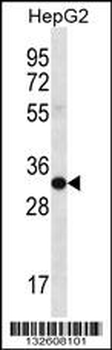 SULT1A3/SULT1A4 Antibody (N-term)