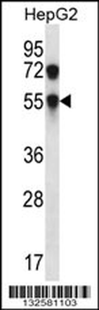 CHST8 Antibody (Center)