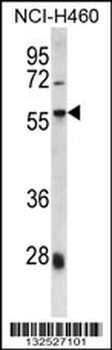 SPAG8 Antibody (C-term)