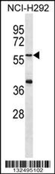 MATN1 Antibody (C-term)