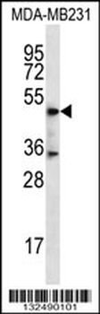 DSN1 Antibody (C-term)