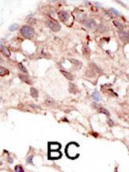 SUV39H2 Antibody (C-term)