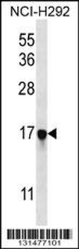 PAGE5 Antibody (C-term)