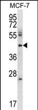 FAXC Antibody (C-term)